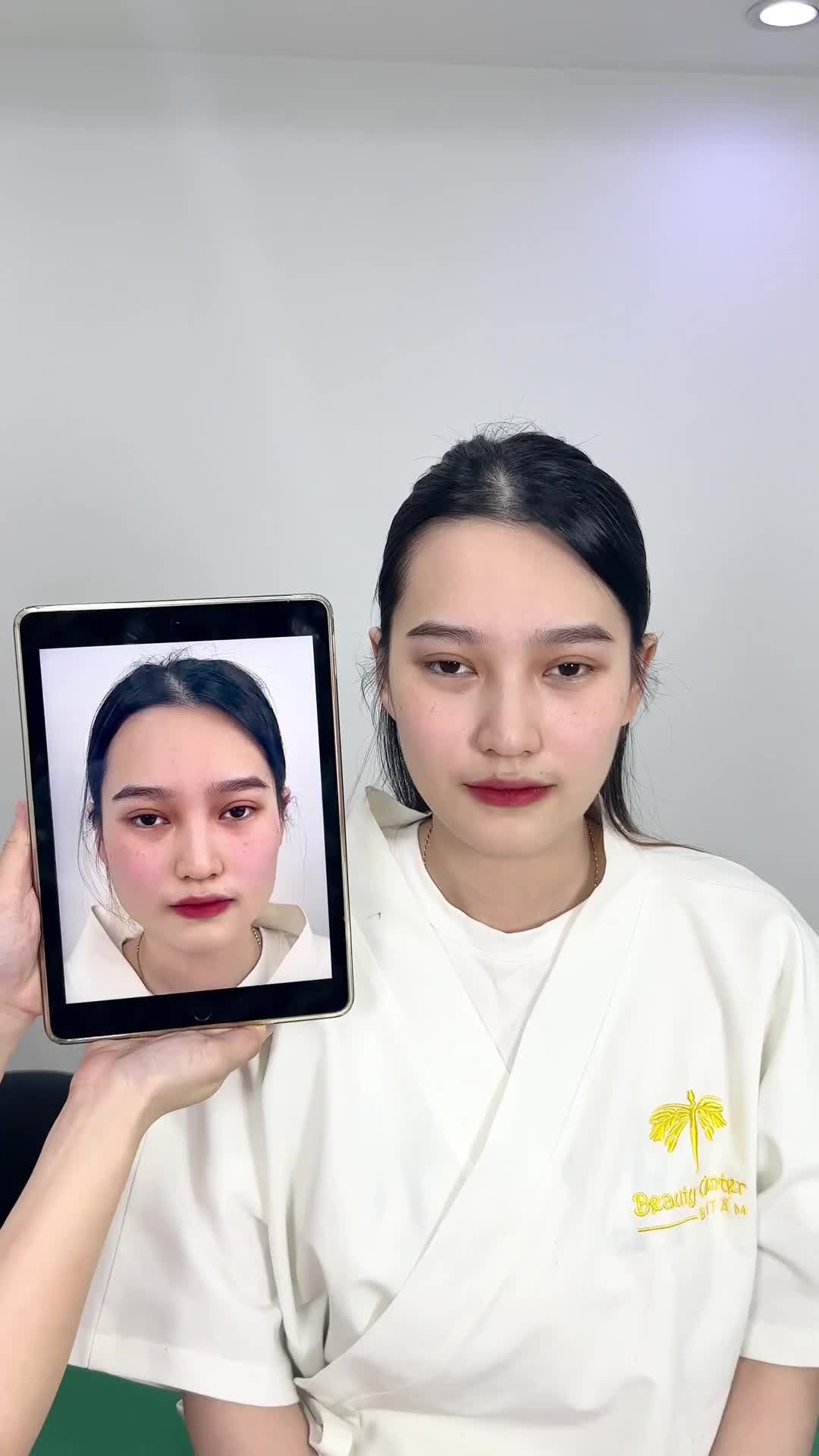 Ca Vline Perfect quay lại tái khám tại TMV Tấm