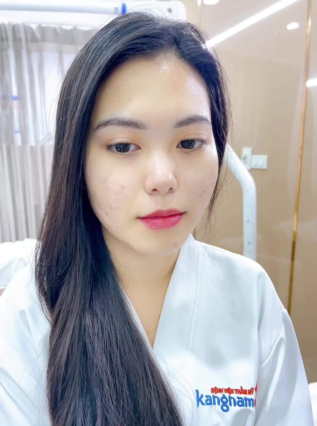 "Nếu biết đẹp được như này thì đi làm lâu rồi"- chia sẻ của khách hàng sau trị sẹo do mụn để lại
