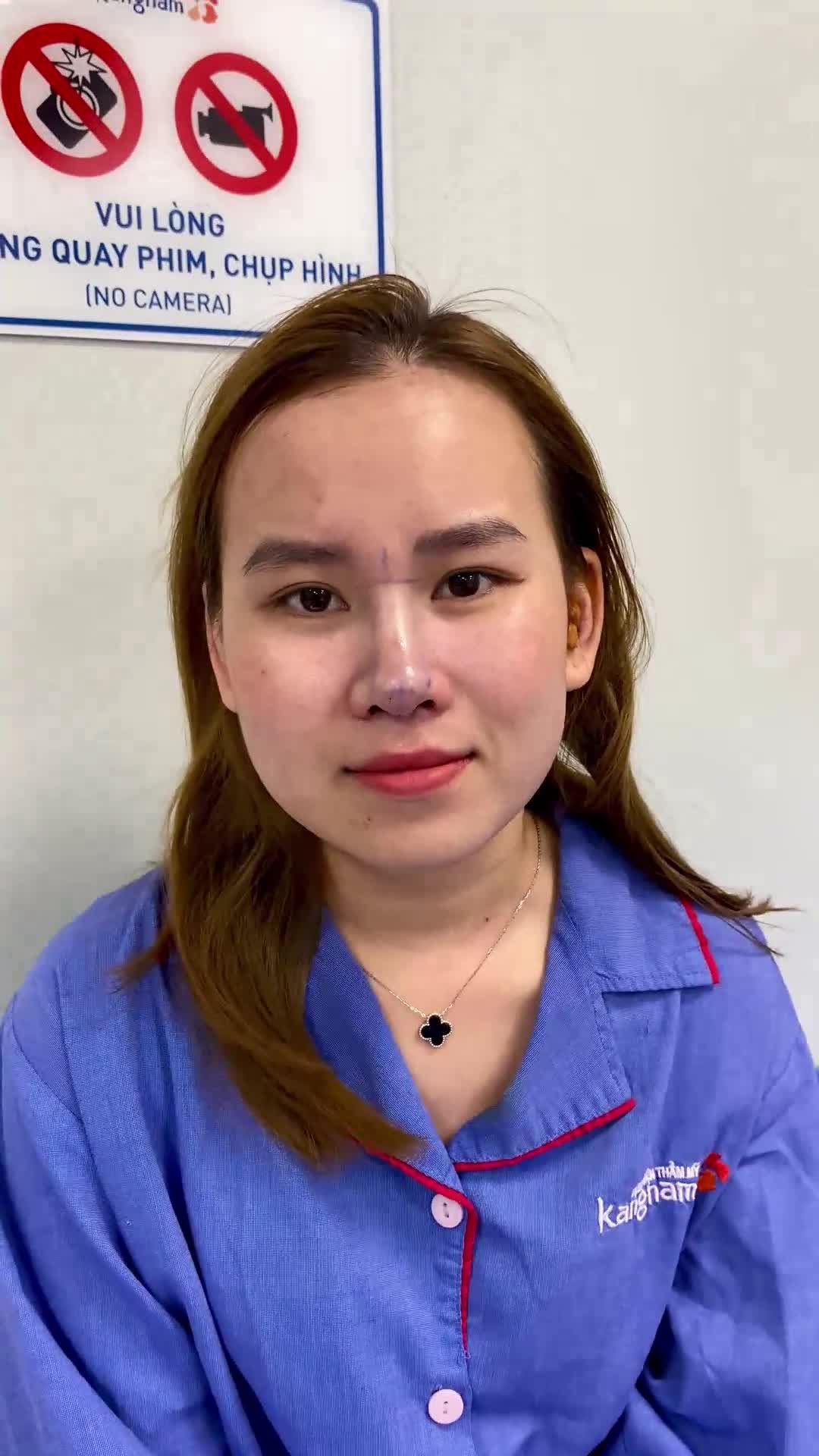 Cô nàng muốn TẾT có mũi cao xinh Tới Kangnam chỉ sau 1 tiếng và CÁI KẾT!