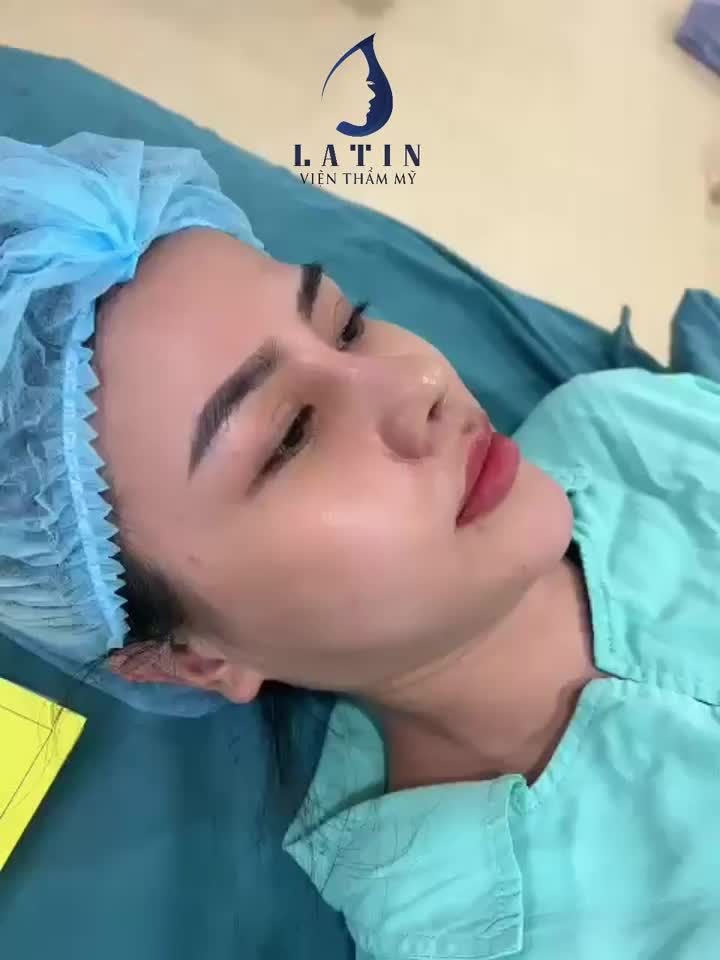 CẬN CẢNH: Mũi 10 ngày tuổi nhà Latin