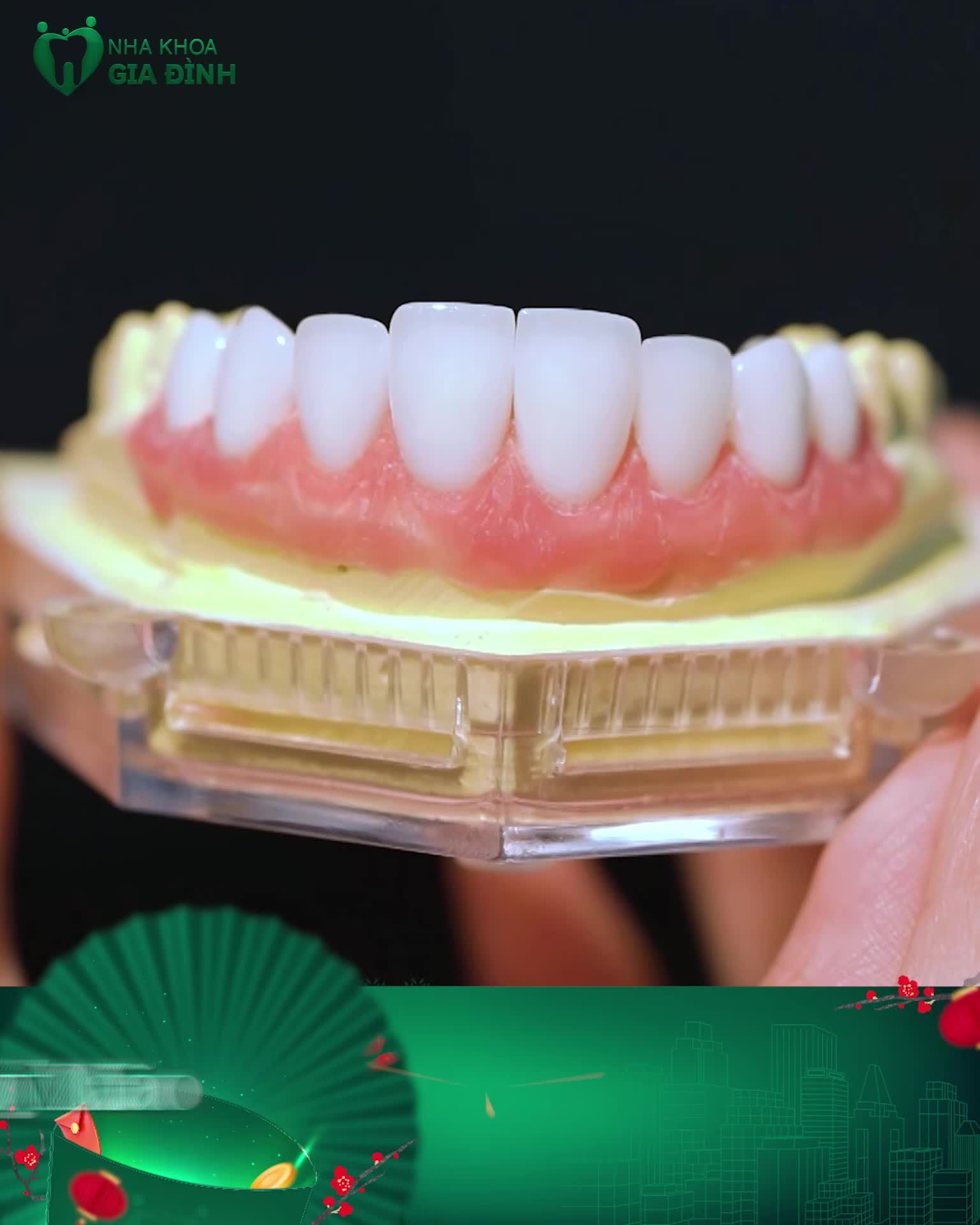 LÀM RĂNG SỨ CHÍNH HÃNG CHỈ SAU 2 LẦN HẸN