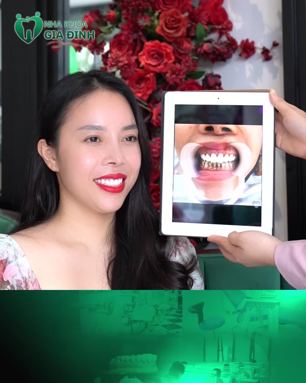 THĂNG HẠNG NỤ CƯỜI - TỰ TIN KHOE NHAN SẮC