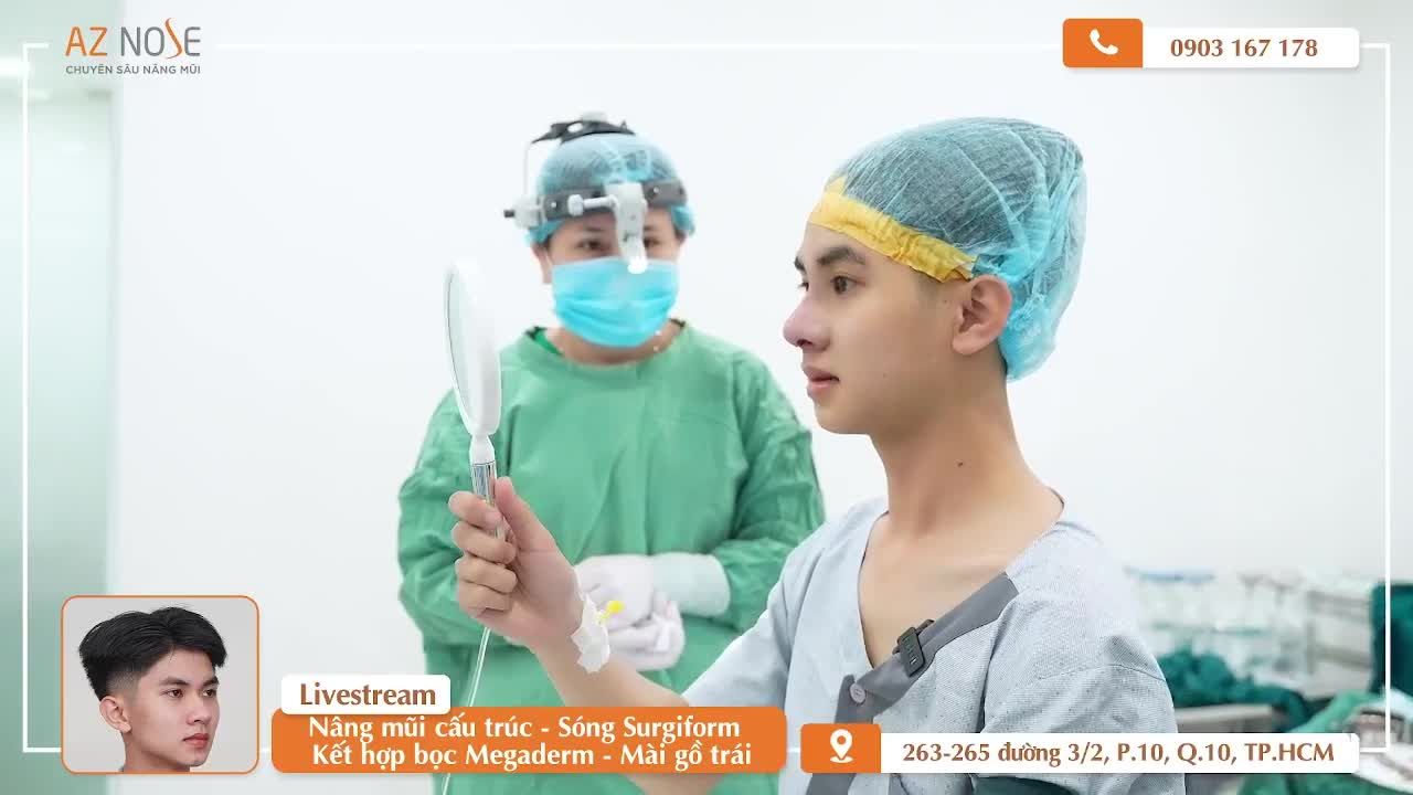 Chàng sinh viên trẻ trung với dáng mũi thực hiện bởi Bác sĩ Hoàng Nhung