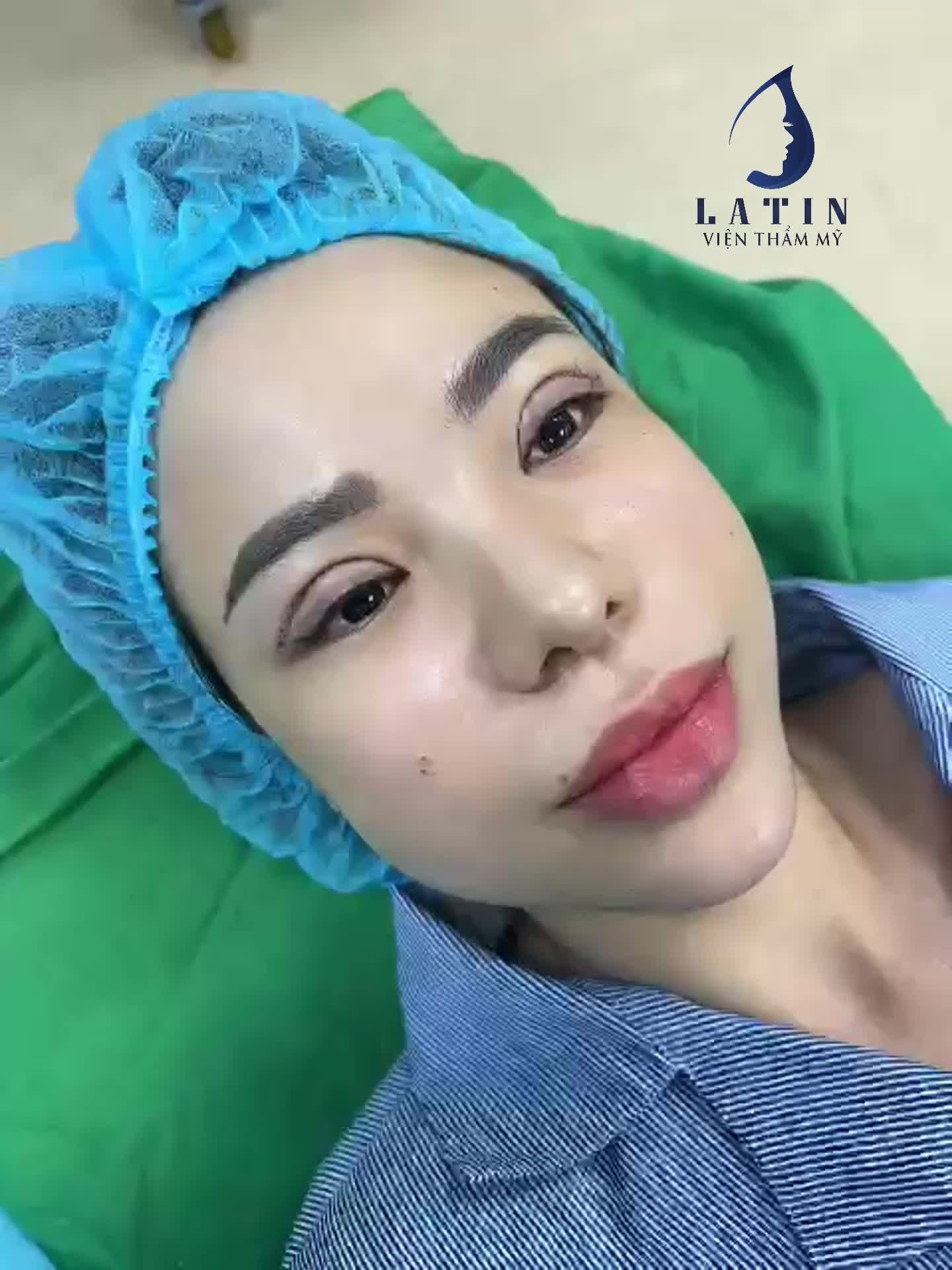 Cắt mí thôi mà, có cần đẹp vậy không