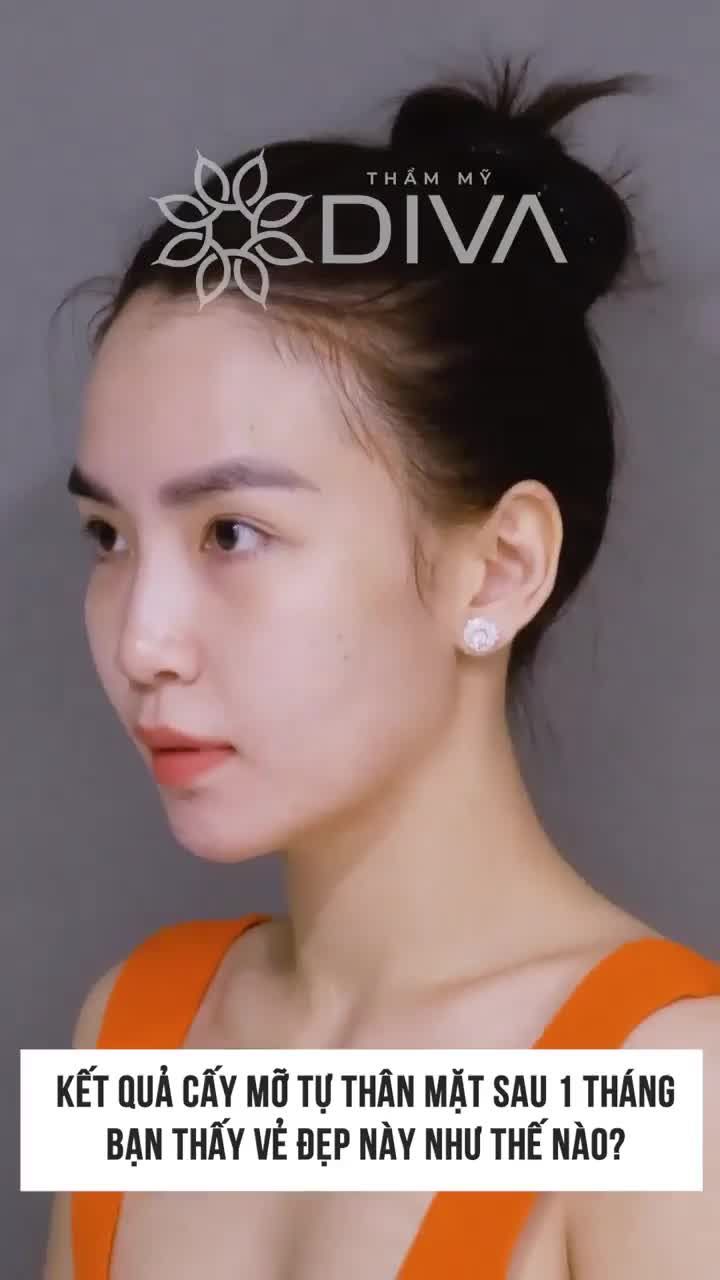 TIÊM MỠ COLEMAN LÀM ĐẸP BẠN CẦN BIẾT ĐIỀU NÀY