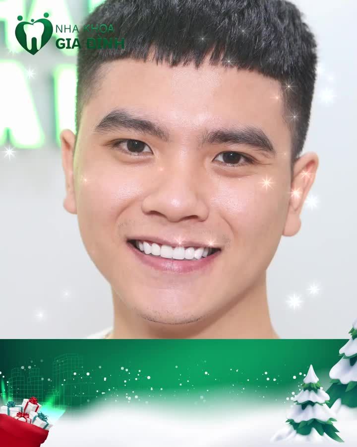 TẶNG BẢN THÂN NỤ CƯỜI RẠNG NGỜI CHO MÙA NOEL NĂM NAY