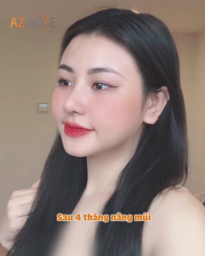 Cô nàng đến AZ NOSE để mang mũi xinh về Bạc Liêu "ăn tết"