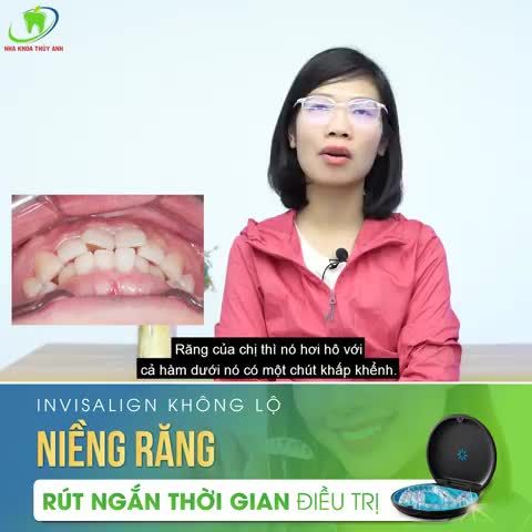 INVISALIGN NIỀNG RĂNG THOẢI MÁI – NIỀNG NHƯ KHÔNG NIỀNG