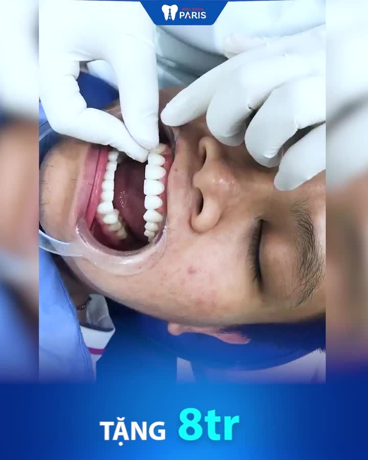 CẬN TẾT LÀM RĂNG SỨ GIÁ TỐT NHẤT NĂM