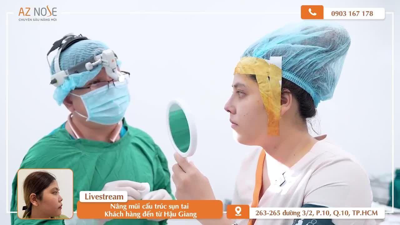 Dáng mũi Sline cao thay đổi khuôn mặt nhiều thế nào?