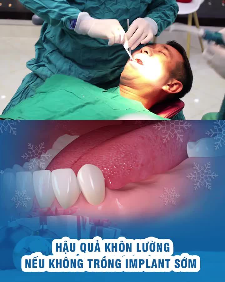 Hậu quả khôn lường nếu không trồng Implant sớm