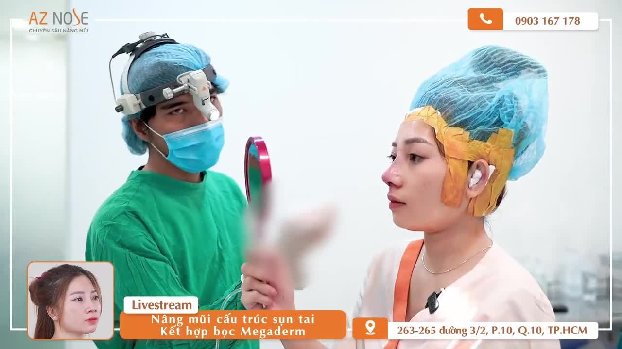 Sở hữu dáng mũi ưng ý với phương pháp nâng mũi cấu trúc