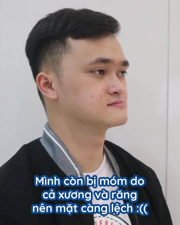 "...NIỀNG RĂNG LÀ QUYẾT ĐỊNH ĐÚNG ĐẮN NHẤT CUỘC ĐỜI ..."