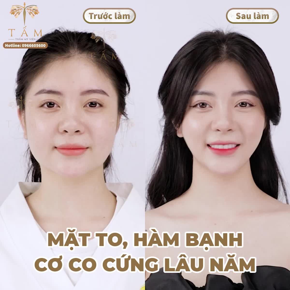 Dễ dàng sở hữu nét đẹp "nàng thơ" khi đến với Tấm