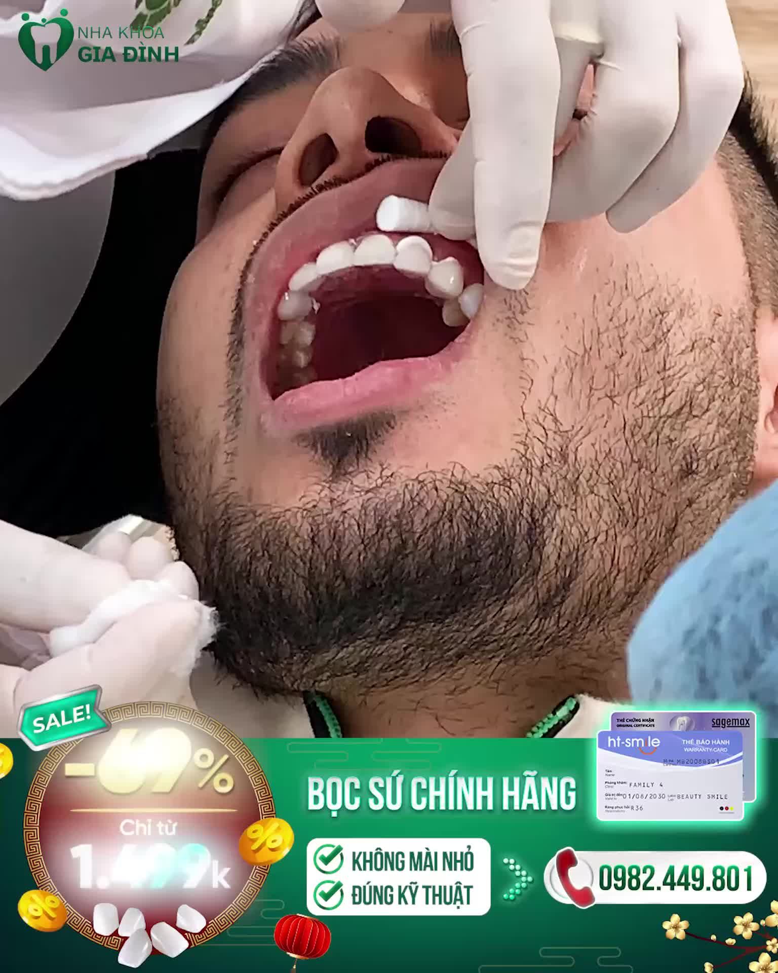 THẨM MỸ RĂNG SỨ KỸ THUẬT CAO: AN TOÀN - BỀN ĐẸP - CHẮC KHỎE