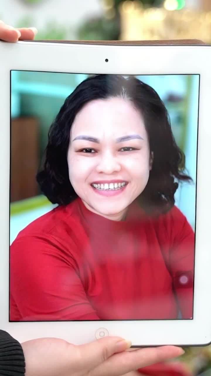 KHÁCH HÀNG THẨM MỸ 18 RĂNG SỨ HT SMILE