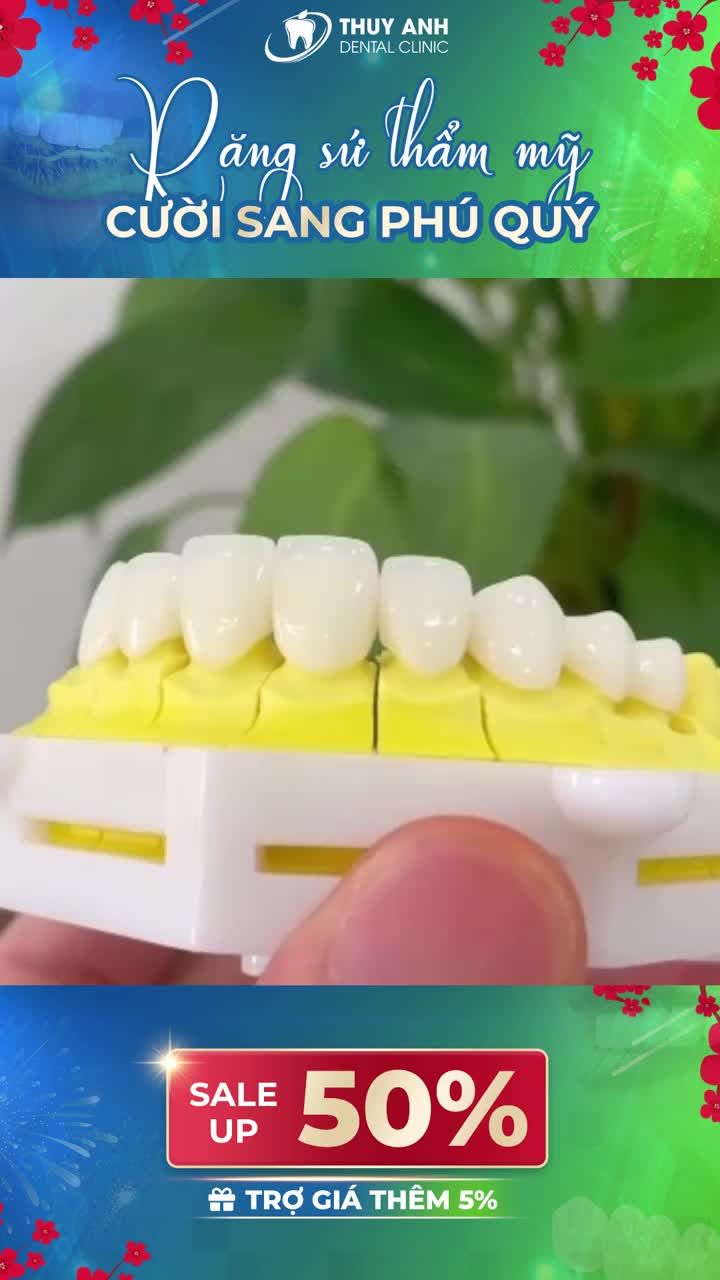 TRÊN TAY BỘ RĂNG SỨ CERAMILL TRƯỚC KHI HOÀN THIỆN NỤ CƯỜI CHO KHÁCH HÀNG
