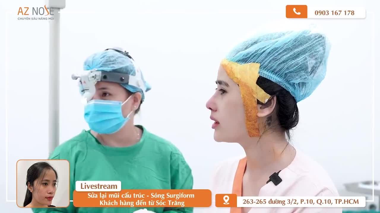 Sở hữu dáng mũi Sline cao với phương pháp nâng mũi cấu trúc