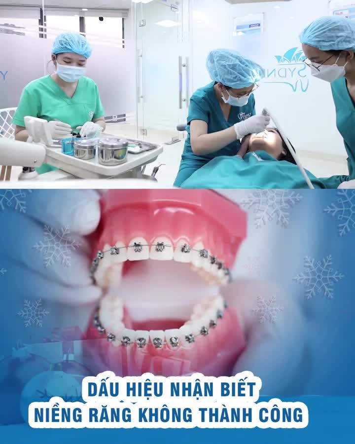 Dấu hiệu nhận biết niềng răng không thành công