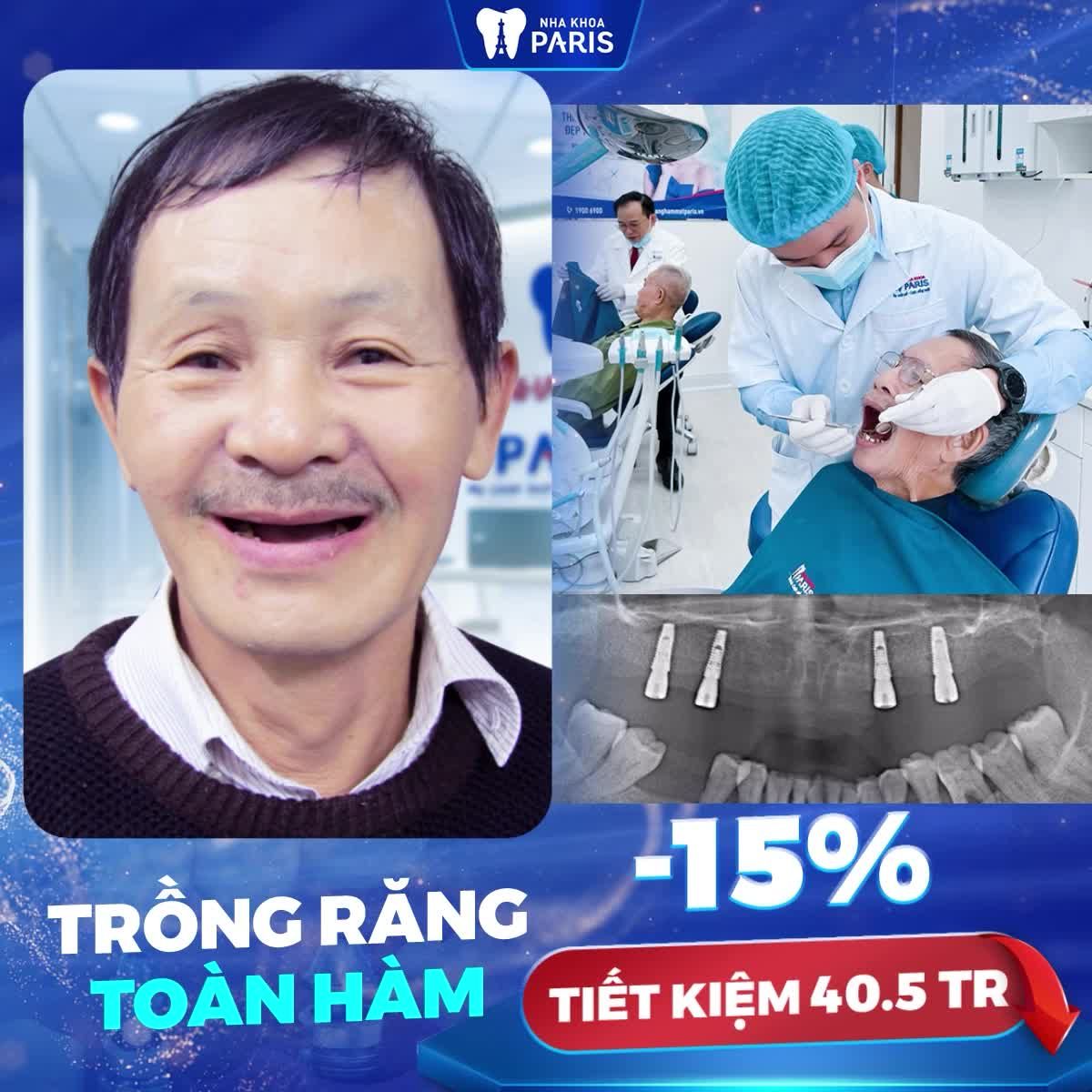 2 BUỔI KHÔI PHỤC RĂNG TOÀN HÀM KỊP TẾT