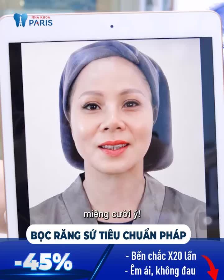 RĂNG NHIỄM MÀU HÔ BIẾN SAU 48 GIỜ