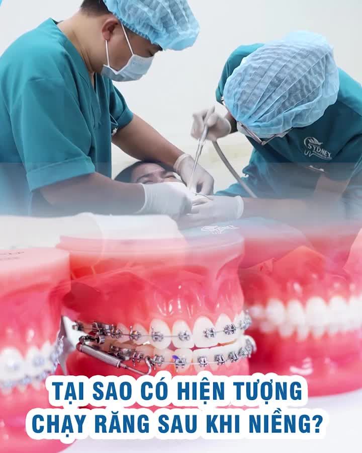 Tại sao có hiện tượng chạy răng sau khi niềng?