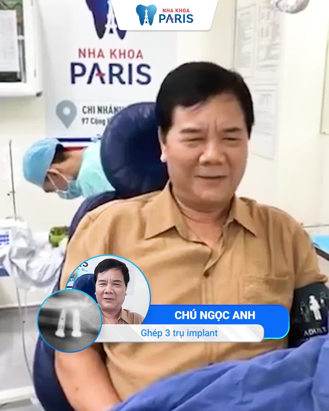 Trồng răng ăn Tết