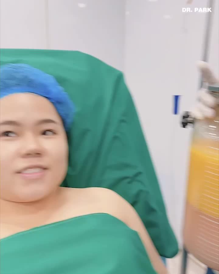 5 LƯU Ý SAU KHI BẠN THỰC HIỆN HÚT MỠ BỤNG