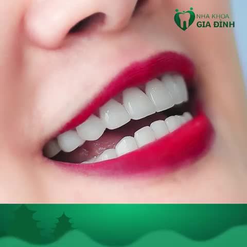 RĂNG TRẮNG RẠNG NGỜI - TẾT TRỌN NIỀM VUI