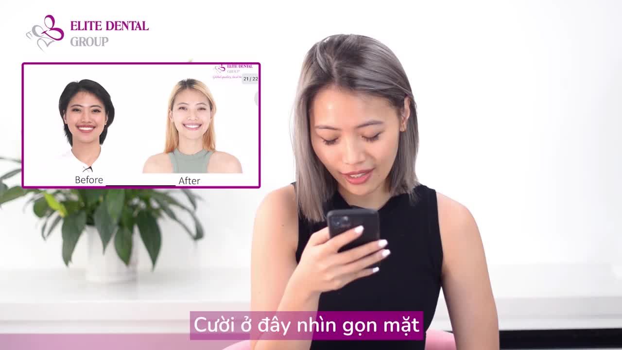 Năm mới, nguồn năng lượng mới sau niềng răng
