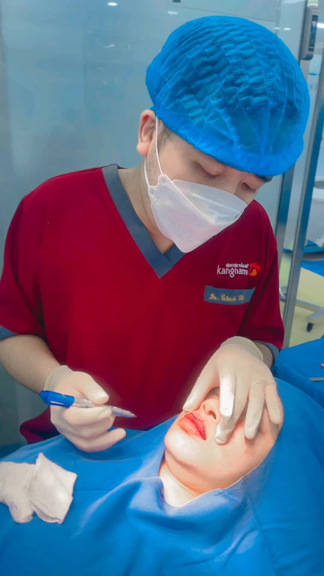 Bs Kangnam phân tích phẫu thuật Thu mỏng và Tạo hình môi tim chị khách hàng có cả môi trên và môi dưới dày