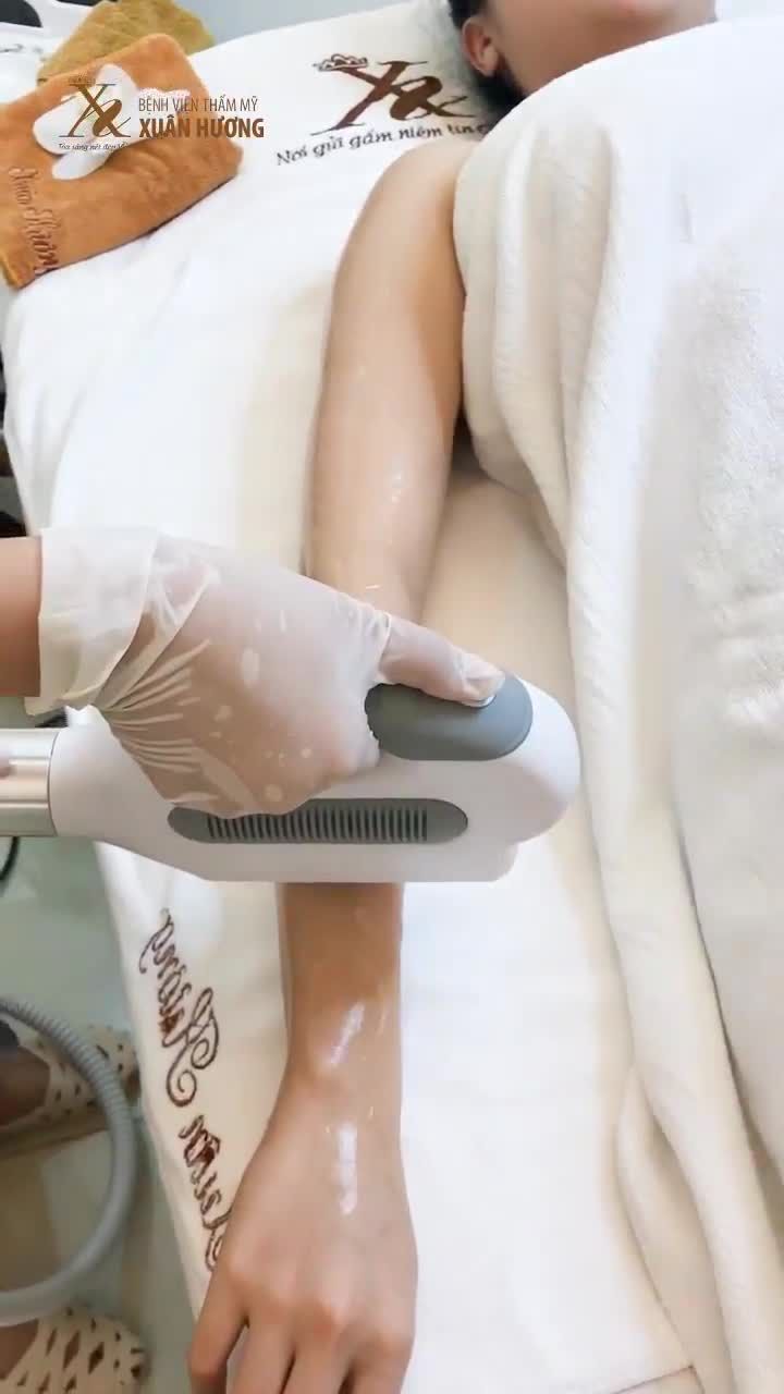 TRIỆT LÔNG NHẸ NHÀNG, KHÔNG NÓNG RÁT, KIỂM CHỨNG NGAY CÙNG KHÁCH HÀNG XUÂN HƯƠNG