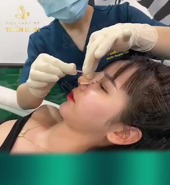 CHỈ 10 NGÀY CÓ NGAY MŨI XINH DIỆN TẾT
