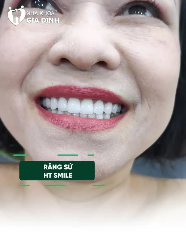 RĂNG NHIỄM MÀU KHÁNG SINH NỖI ÁM ẢNH CỦA BIẾT BAO THẾ HỆ