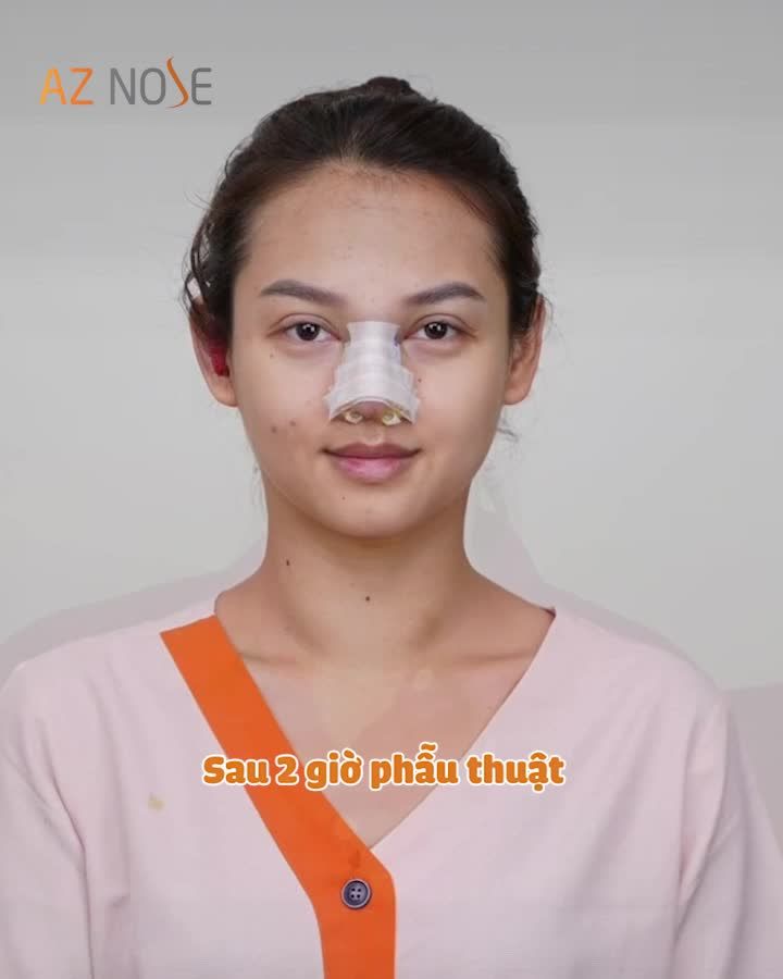 MŨI CAO XINH - TỰ TIN ĐÓN NĂM MỚI