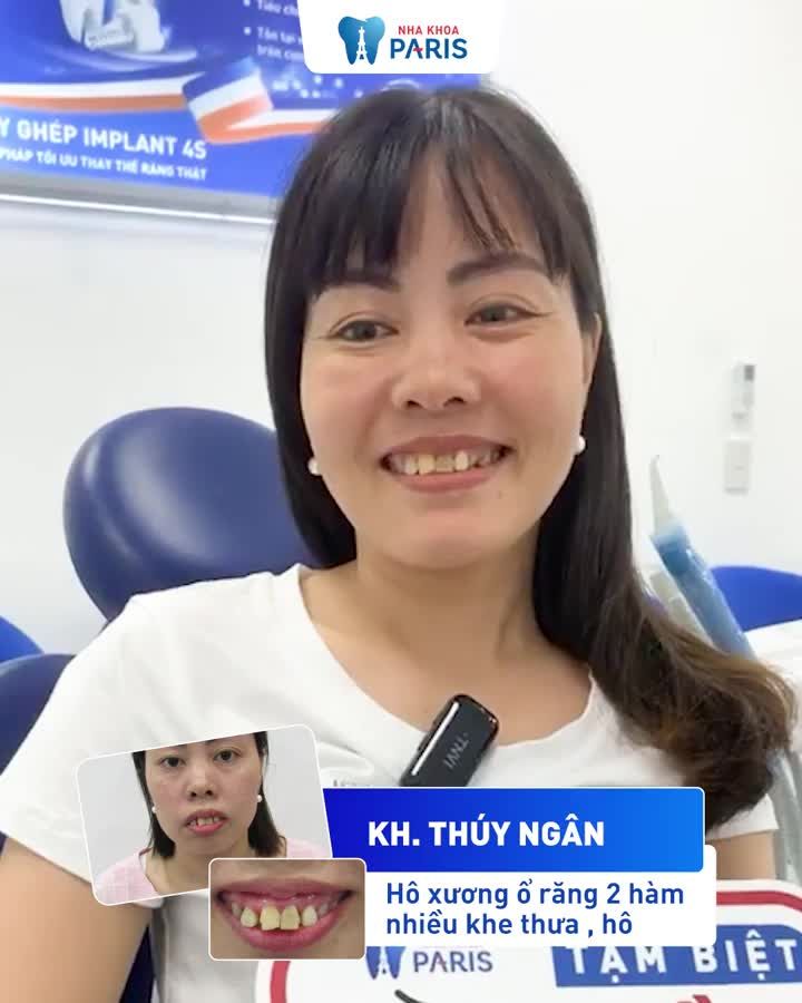“Răng xấu đến đâu cũng đẹp tại Paris”