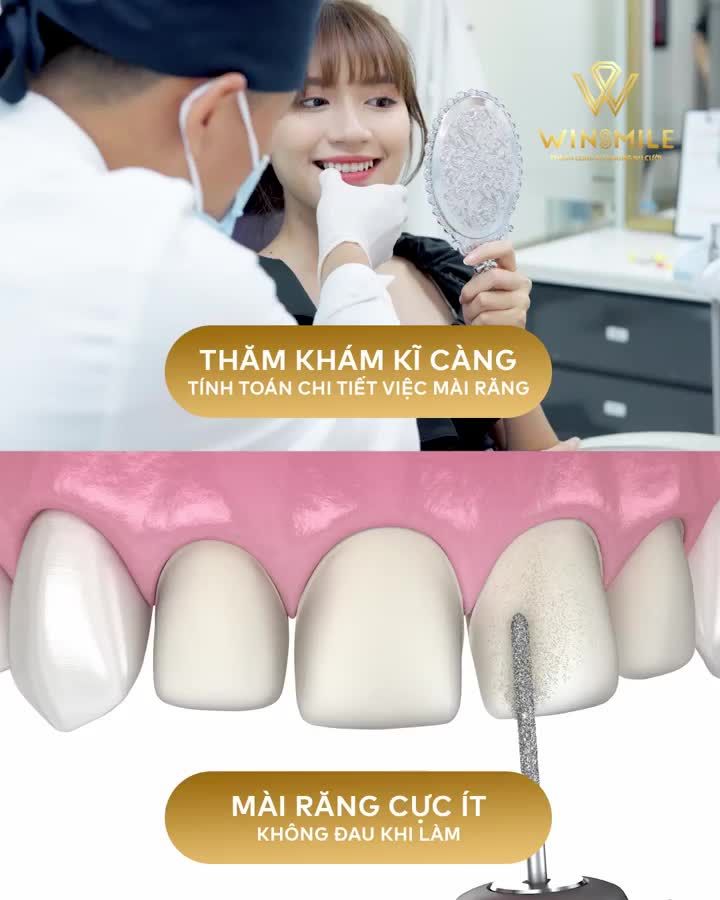 LÀM RĂNG SỨ CÓ ĐAU KHÔNG?