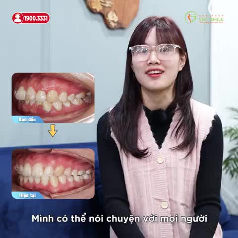 GIAO TIẾP THOẢI MÁI HƠN SAU THÁO NIỀNG RĂNG HÔ, CHEN CHÚC, CẮN SÂU