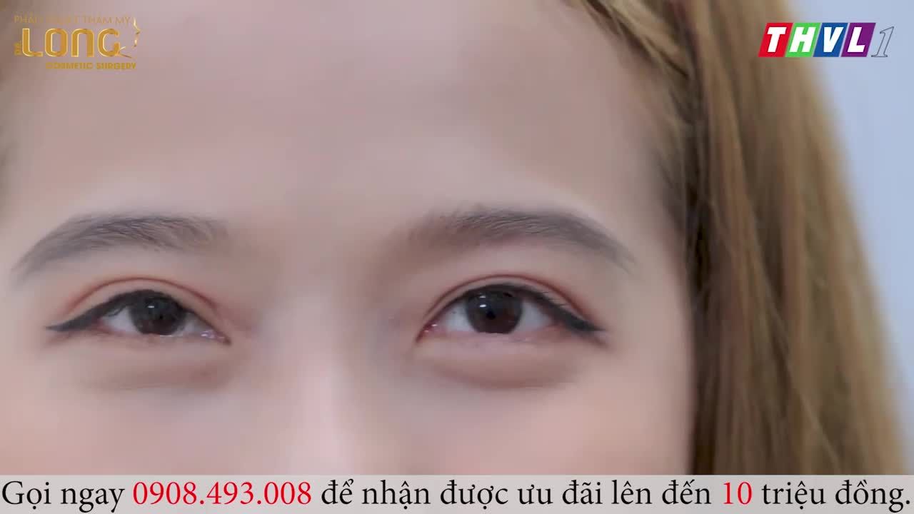 Mọi người có tin chỉ cần cắt mí mắt là có người yêu thương bên đời không nào?