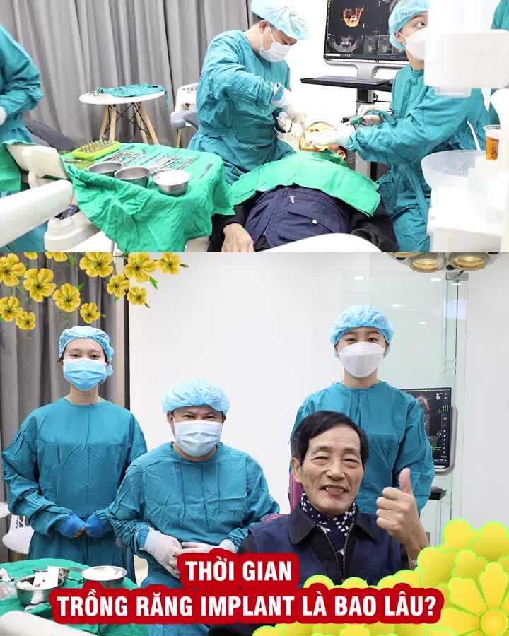 Thời gian trồng Implant là bao lâu?