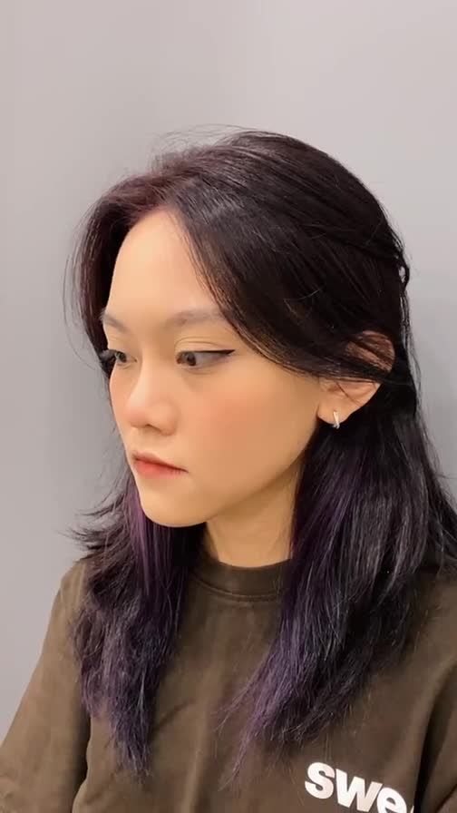 TÁI KHÁM KHÁCH HÀNG NÂNG MŨI, CHỈNH XƯƠNG SAU 3 THÁNG