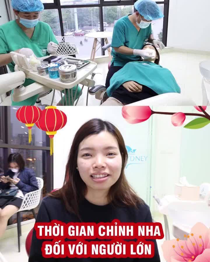Thời gian chỉnh nha đối với người lớn?