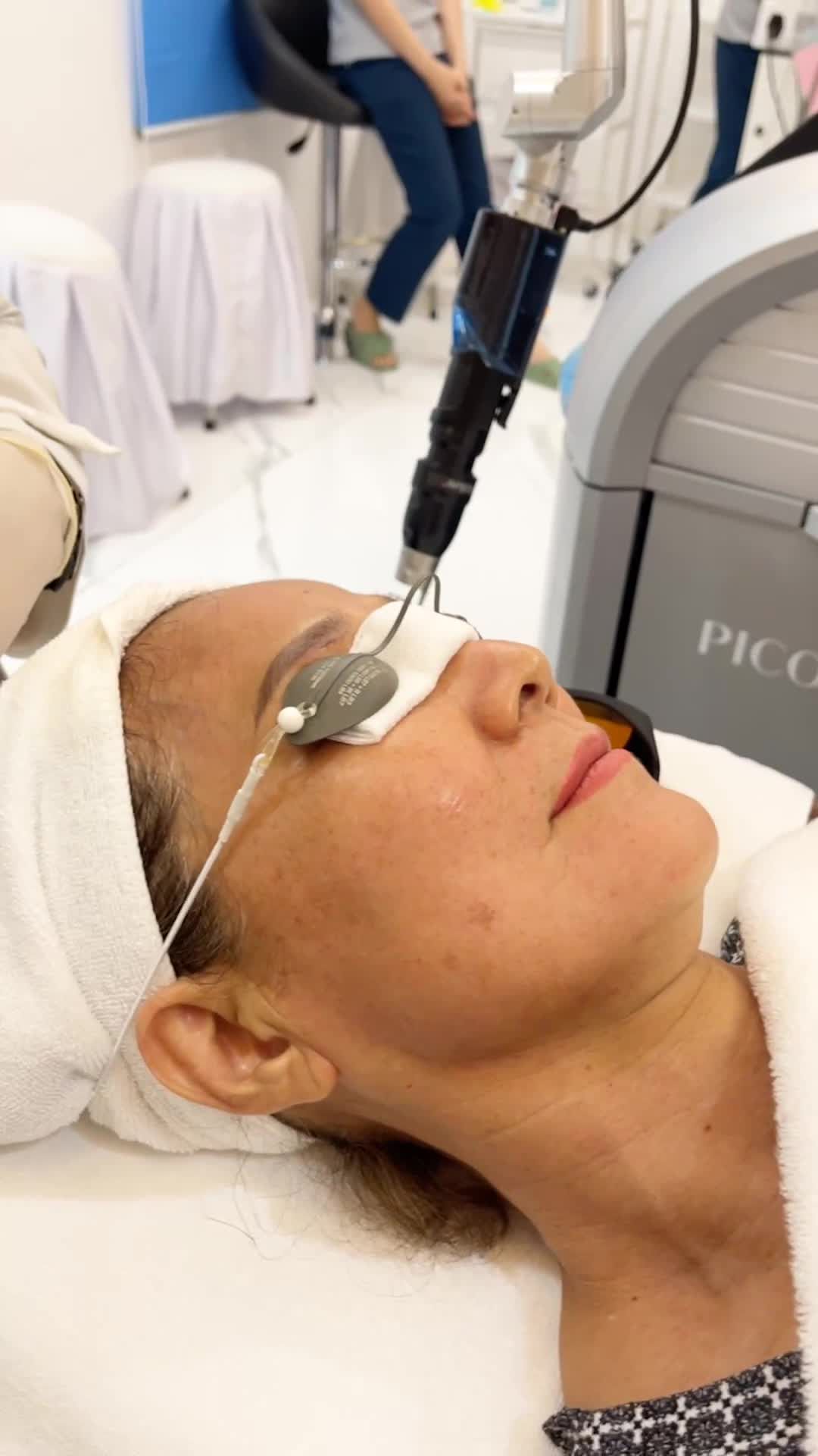 Điều trị tàn nhàng hiểu quả Chỉ 1 lần duy nhất với công nghệ Laser Picosure Pro tại Kangnam