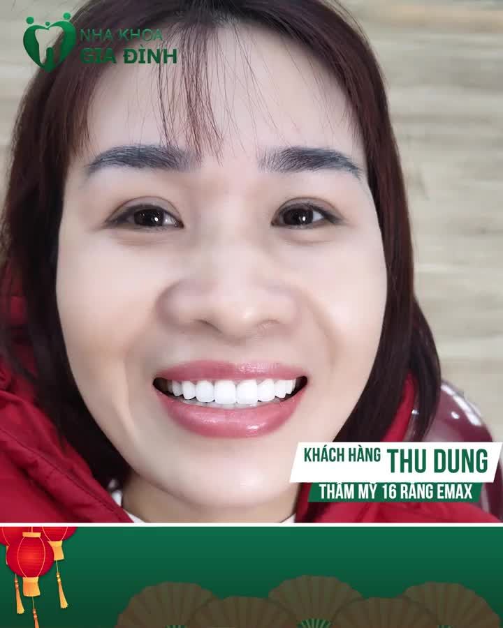 RĂNG THƯA, Ố VÀNG NAY CHỈ CÒN LÀ DĨ VÃNG