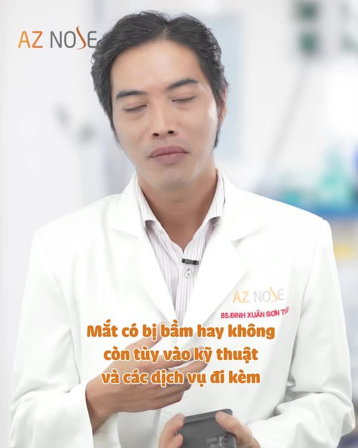 Giải đáp về tình trạng mắt s.ư.ng b.ầm sau nâng mũi