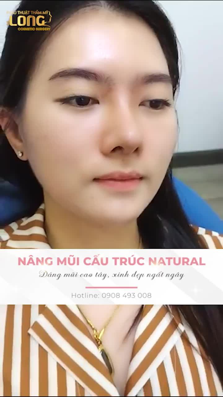 ẨN TÌNH SAU DÁNG MŨI XINH RINH TÀI LỘC