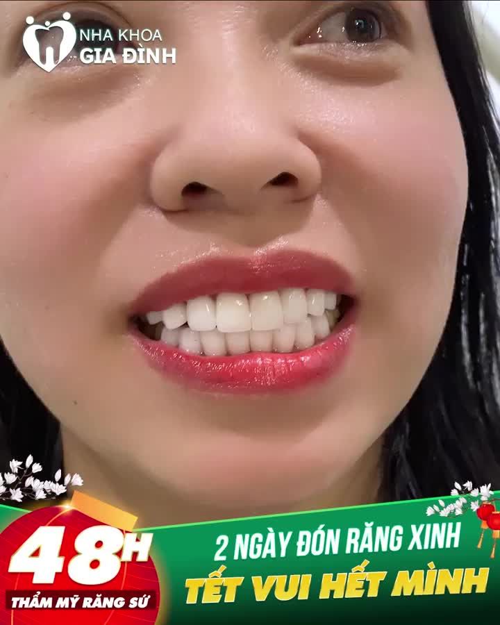 GIAO TIẾP BỊ HẠN CHẾ - MẶC CẢM VÌ RĂNG XẤU