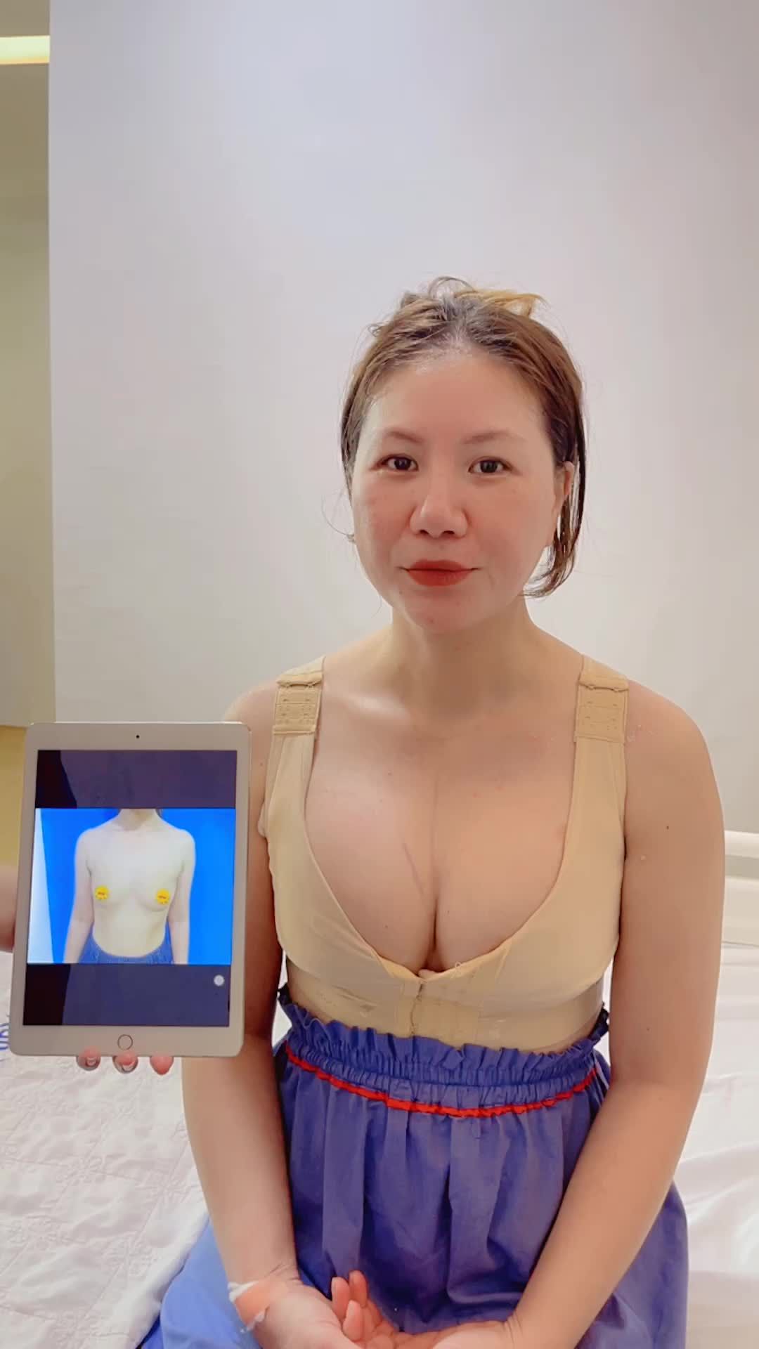 Kết quả bất ngờ với Dịch vụ Nâng ngực tại KANGNAM đẹp kịp Tết