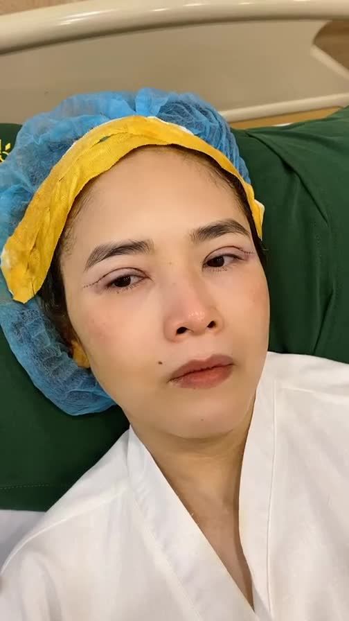 CA CẮT MÍ VỪA HOÀN THÀNH TẠI TRUNG TÂM BÁC SĨ KHẢI