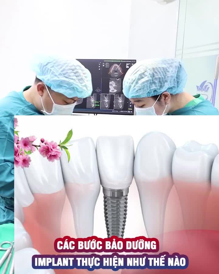 Các bước bảo dưỡng Implant thực hiện như thế nào?